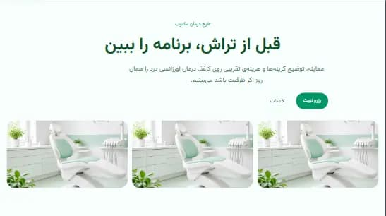 پیشنمایش قالب سپیدهدندان